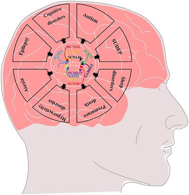 Up to What Extent Does Dravet Syndrome Benefit From Neurostimulation Techniques?